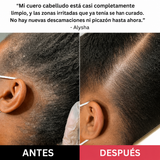 Revivir + Restaurar el Exfoliante del Cuero Cabelludo VYREN