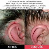 Revivir + Restaurar el Exfoliante del Cuero Cabelludo VYREN